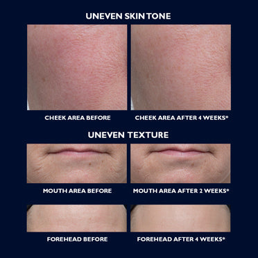 Retinol Night Serum + Radiant Renewal Set