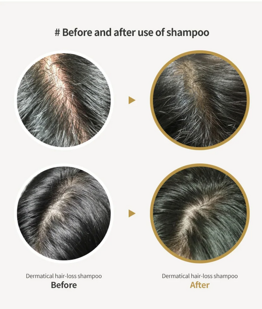 Dermatical Hair-Loss Shampoo
