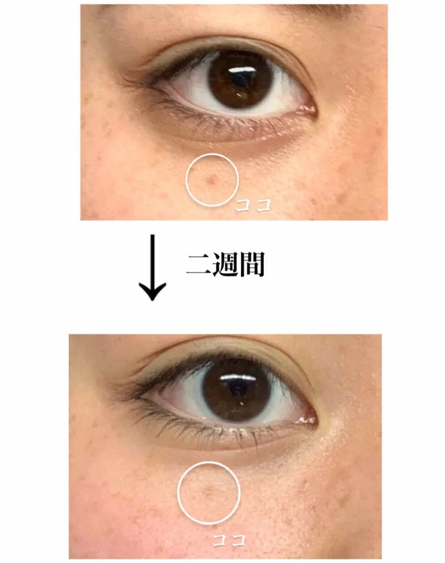 Melano CC - Anti-spot Vitamin C Essence 20g