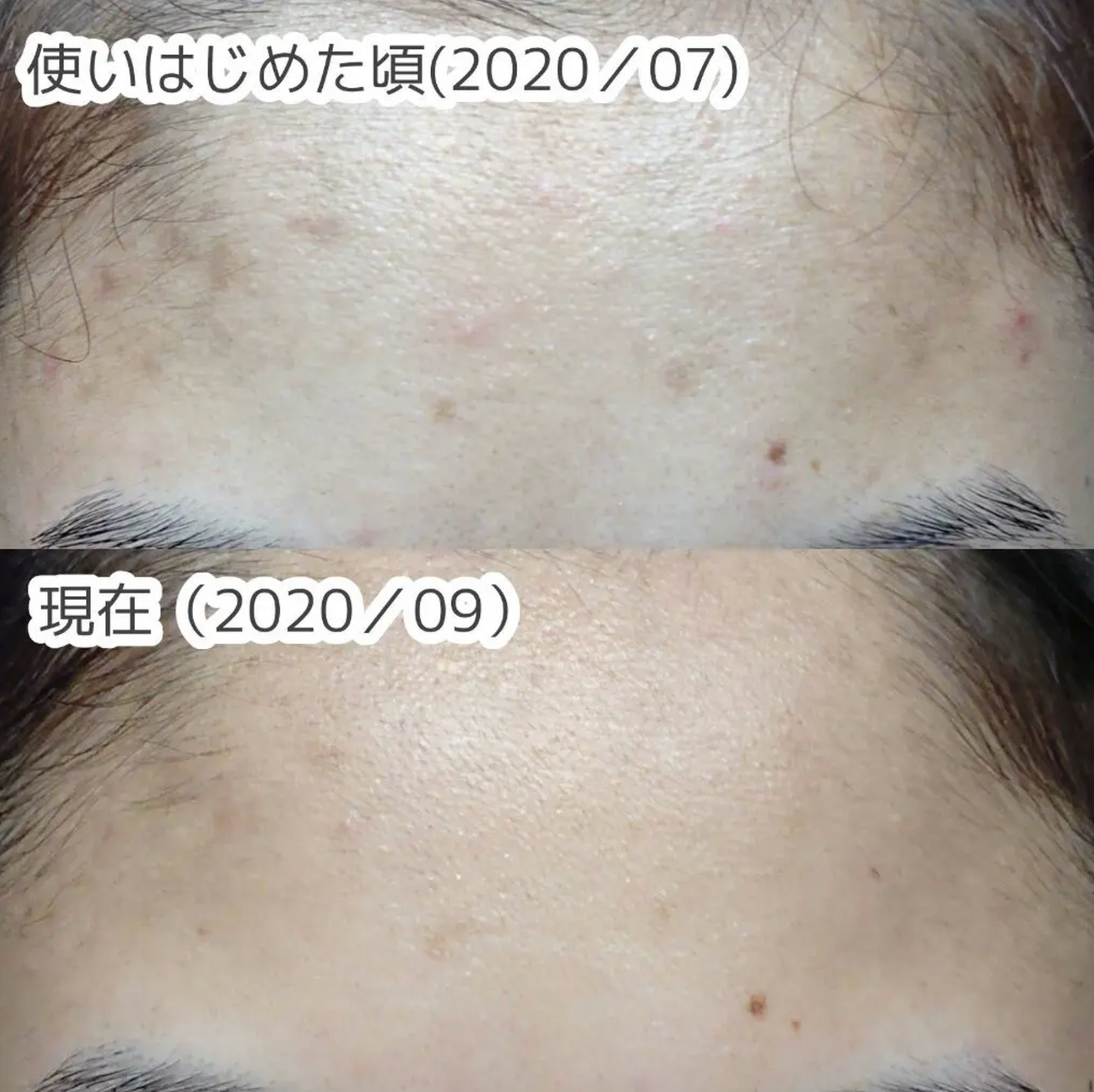 Melano CC - Anti-spot Vitamin C Essence 20g