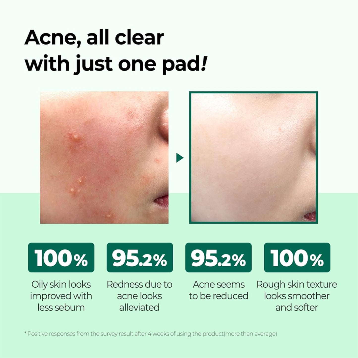 SOMEBYMI AHA-BHA-PHA 30 days Miracle Truecica Clear Pad