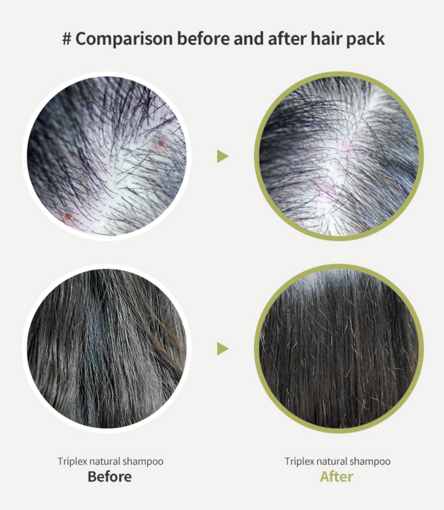 Tea Tree Scalp Clinic Hair Pack 200g