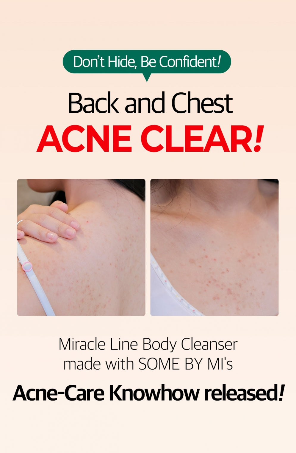 AHA-BHA-PHA 30 days Miracle Acne Body Cleanser